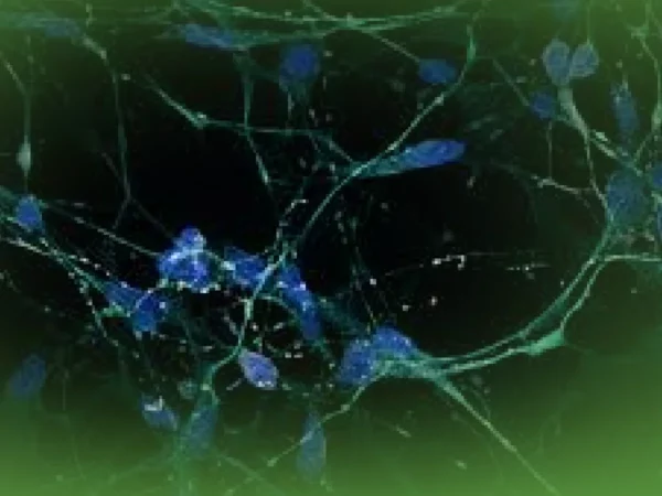 Imagem fluorescente de células neurais com conexões intrincadas destacadas em Explicações de Morfologia ONU sobre fundo verde escuro. Pacote de Horas